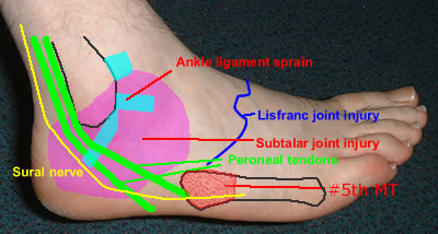 lat foot injuries